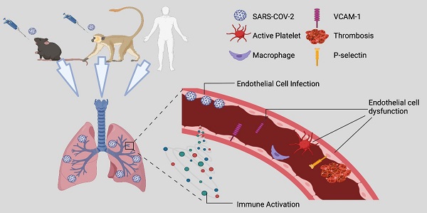 Endothelial cell infection and endotheliitis in COVID-19 - The Lancet