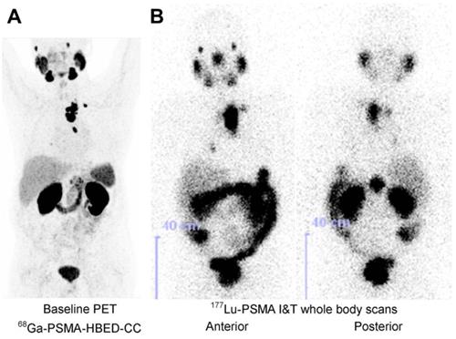 Theranostics Image