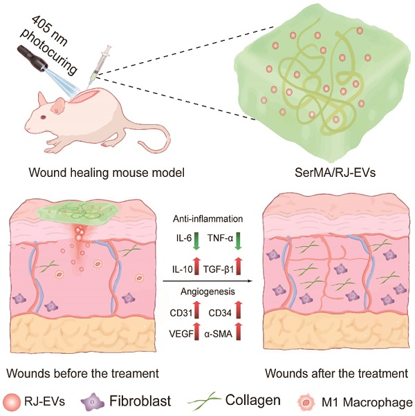 Wound Dressing: From Nanomaterials to Diagnostic Dressings and Healing  Evaluations