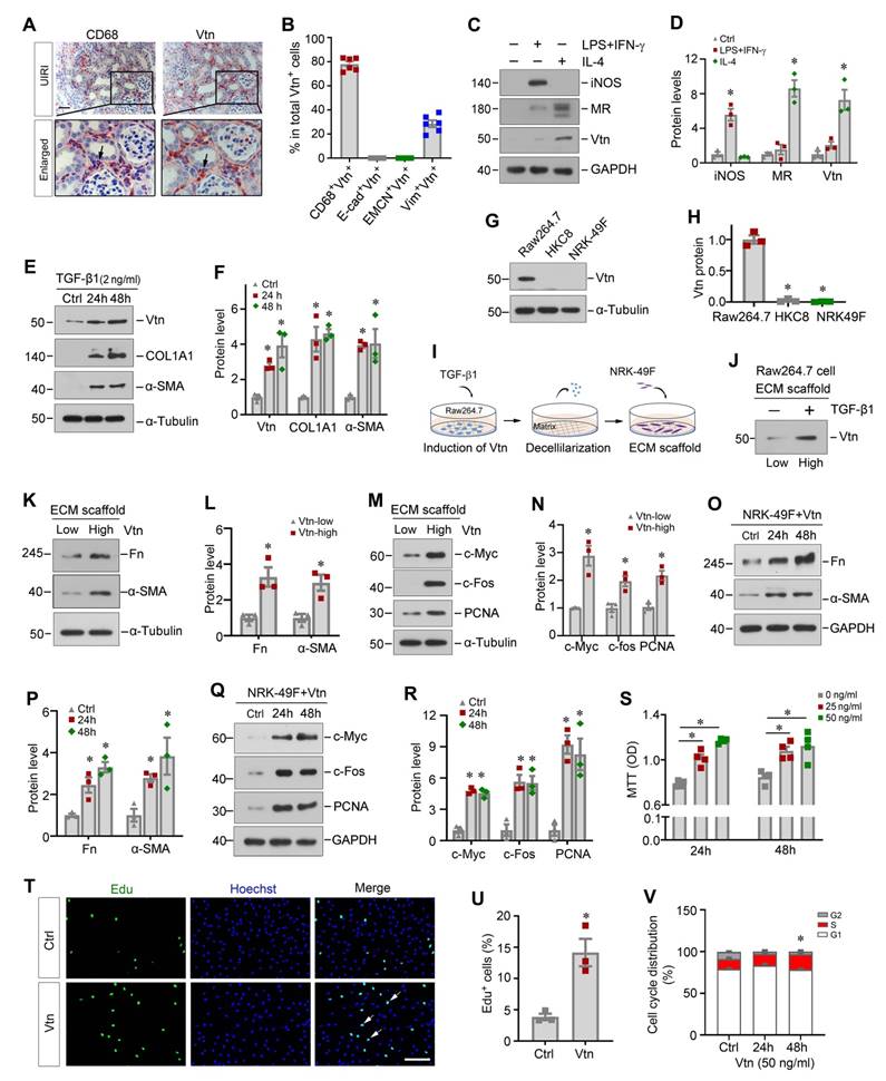 Macrophage promotes fibroblast activation and kidney fibrosis by ...