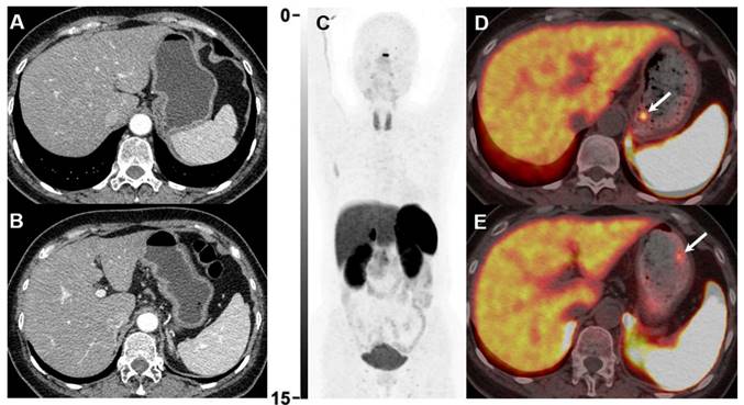 Theranostics Image