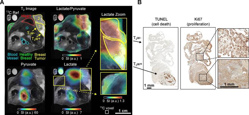 Theranostics Image