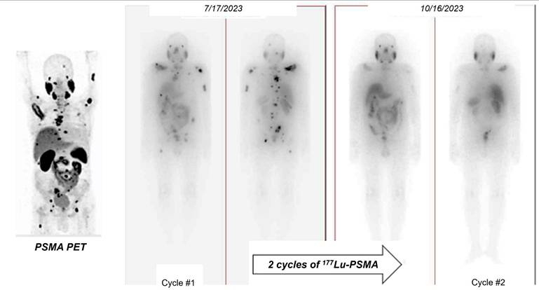 Theranostics Image