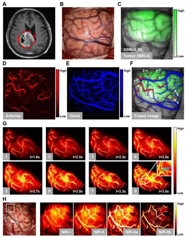 Theranostics Image