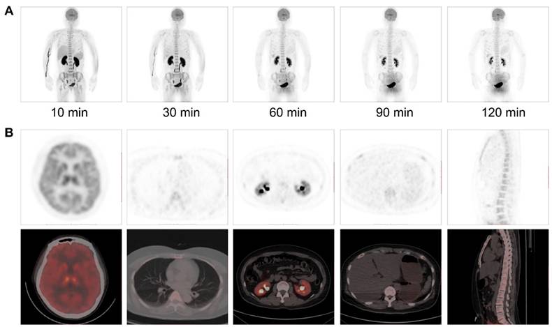Theranostics Image