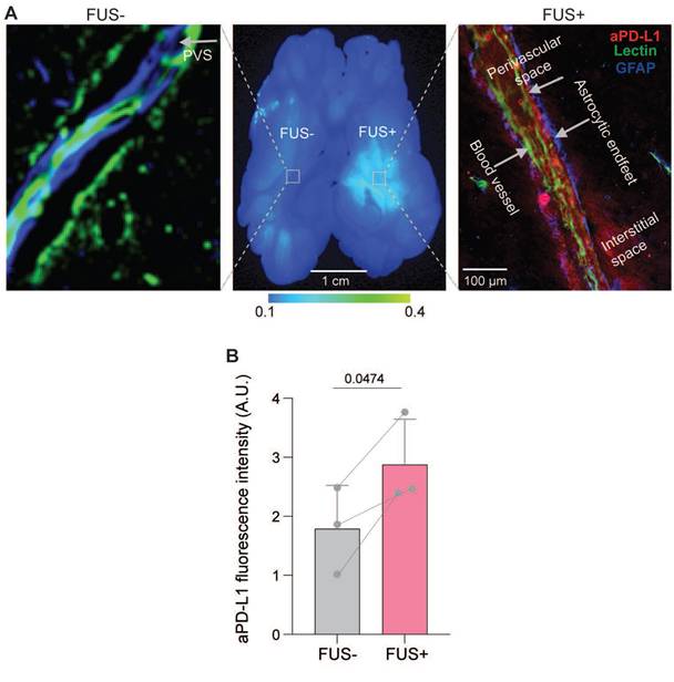 Theranostics Image