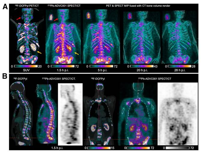 Theranostics Image
