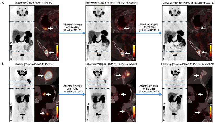 Theranostics Image