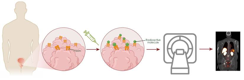 Theranostics Image