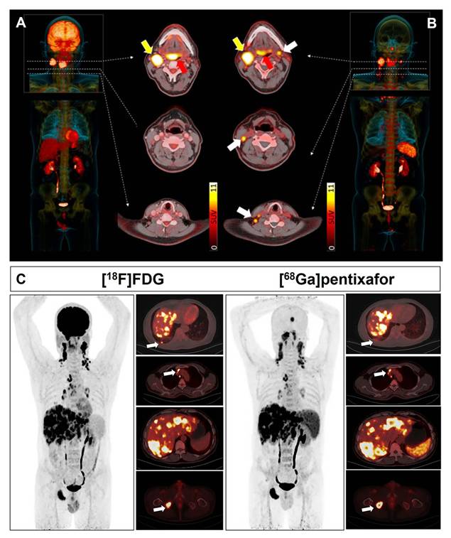 Theranostics Image