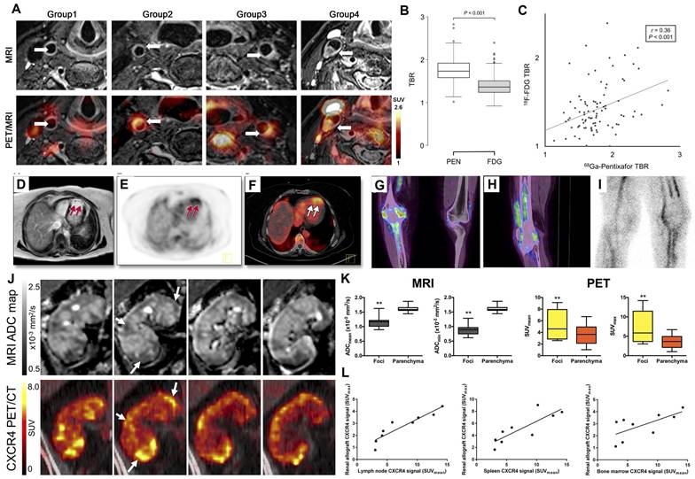 Theranostics Image