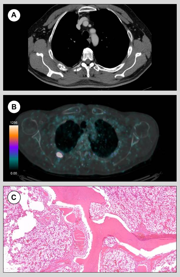 Theranostics Image
