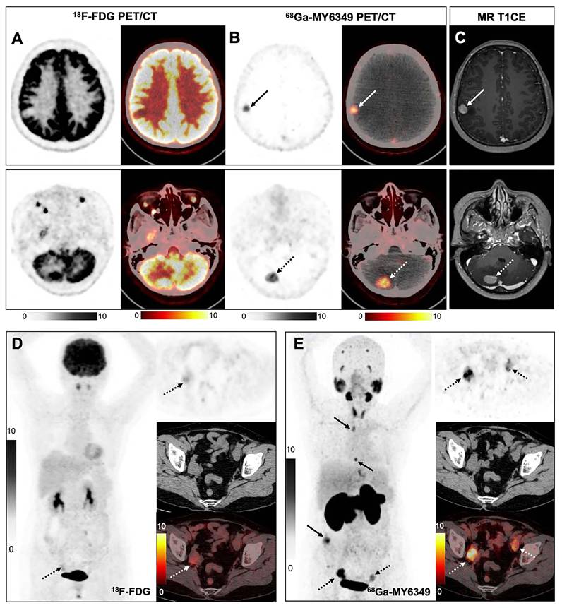 Theranostics Image