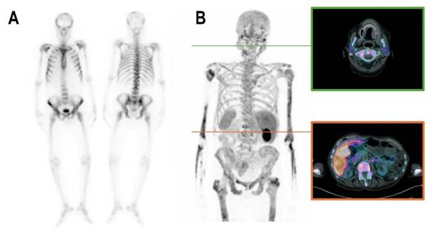 Theranostics Image