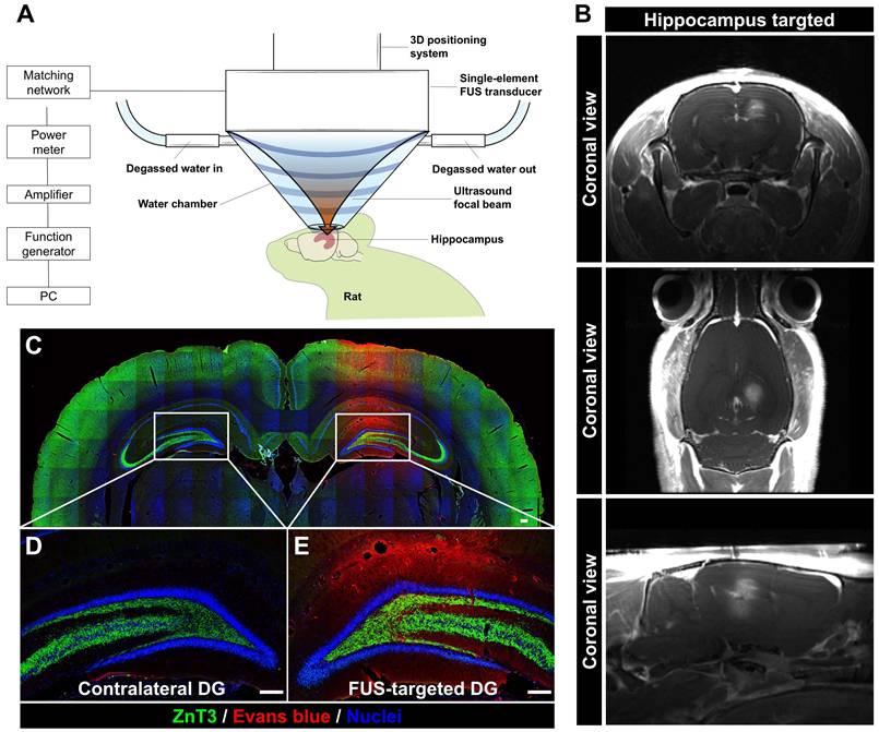 Theranostics Image