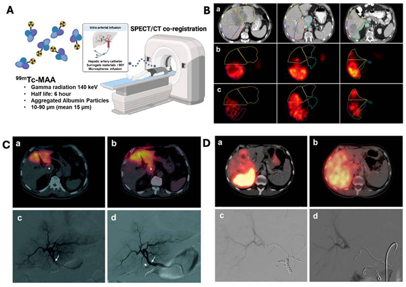 Theranostics Image