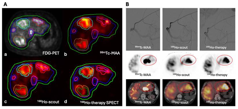 Theranostics Image