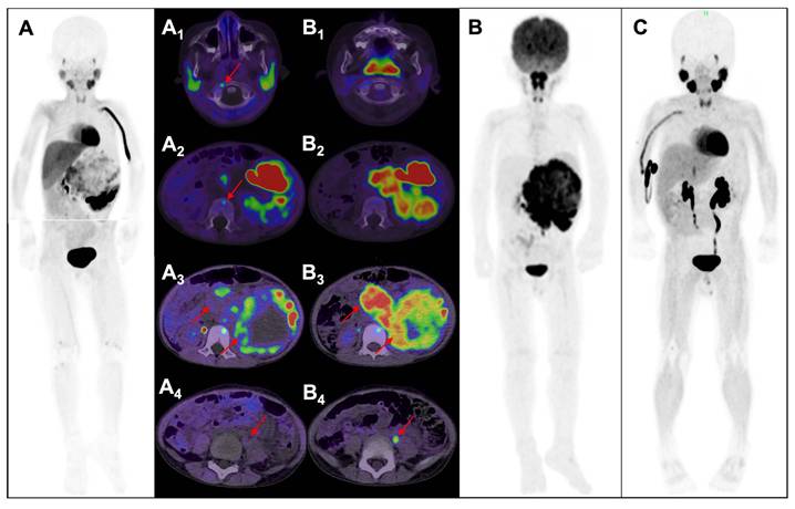 Theranostics Image